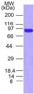 SARS-CoV-2 (2019-nCoV) Spike S1, Southern California mutant (S13l / W152C / L452R) His Tag Protein