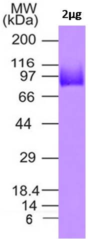 SARS CoV2 Spike S1 C-Term His Tag Protein