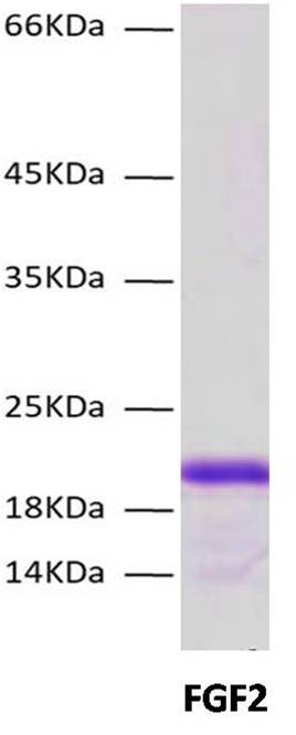 SARS CoV2 Spike S1 C-Term His Tag Protein