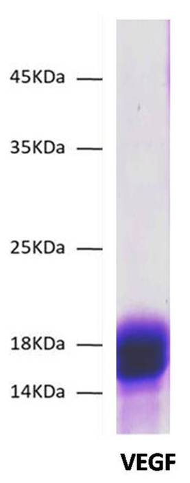 SARS CoV2 Spike S1 C-Term His Tag Protein