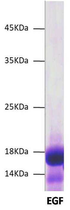 SARS CoV2 Spike S1 C-Term His Tag Protein