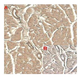 anti-IL-33 (human), mAb (IL33305B)