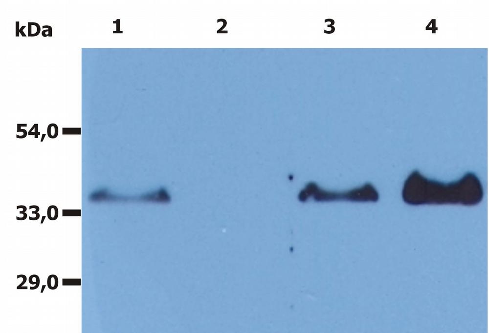 Anti-CD20 Monoclonal Antibody (Clone:MEM-97)-Azide free