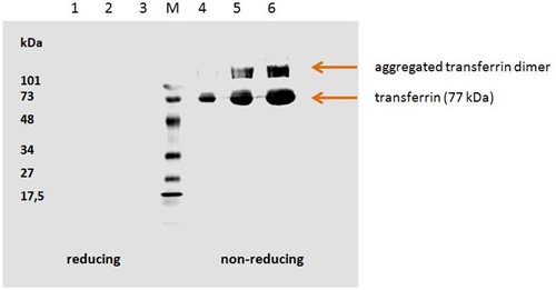 Azide free Anti-Transferrin Monoclonal Antibody (Clone:HTF-14)