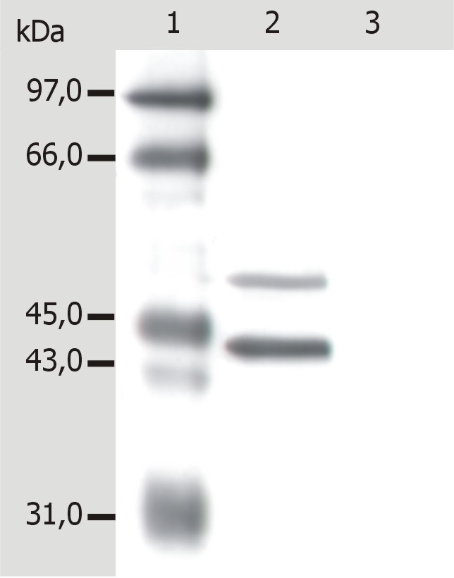 Anti-Cytokeratin 5/8 Monoclonal Antibody (Clone:C-50)