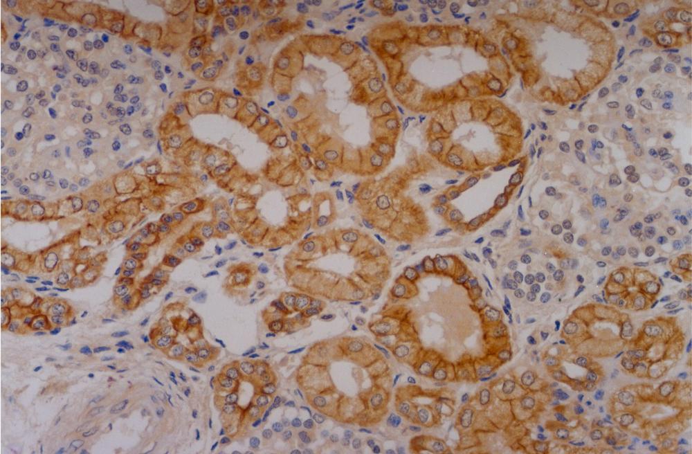 Anti-Cytokeratin 18 Monoclonal Antibody (Clone:C-04)