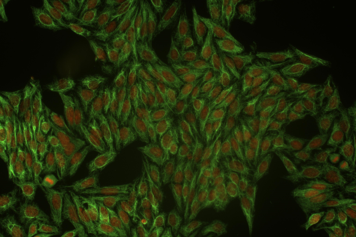 Anti-Cytokeratin 18 Monoclonal Antibody (Clone:DC-10)