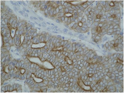 Anti-Cytokeratin (Pan-reactive) Monoclonal Antibody (Clone:C-11)