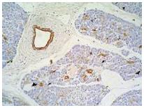 Anti-Cytokeratin 7+17 Monoclonal Antibody (Clone:C-46)