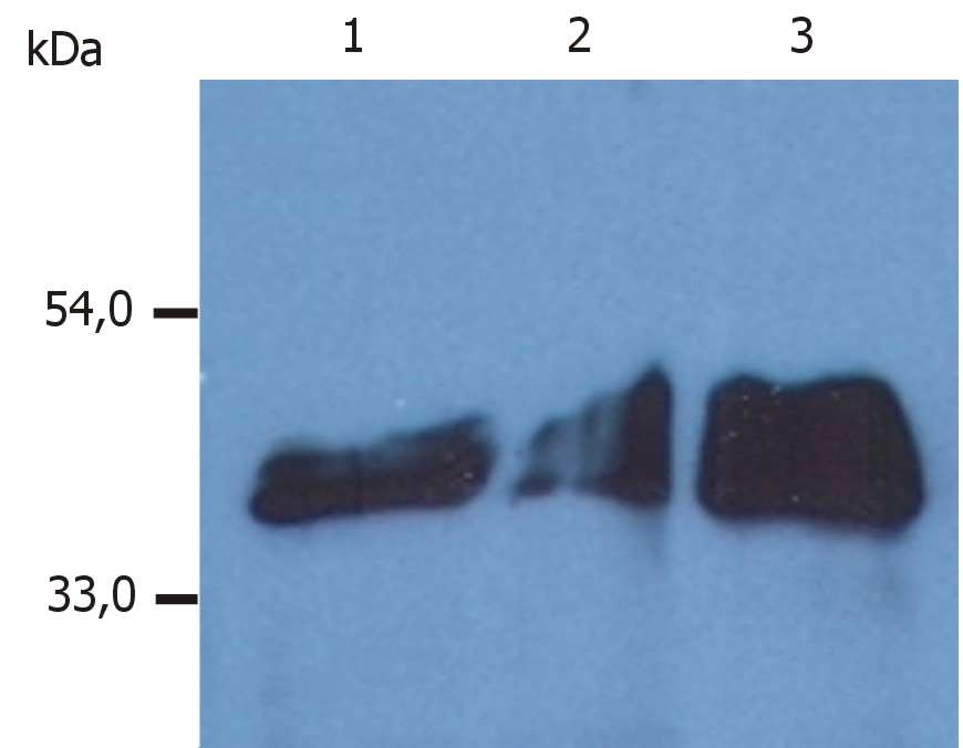 Anti-Cytokeratin 18 Monoclonal Antibody (Clone:DA-7)