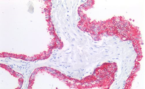 Anti-Cytokeratin 19 Monoclonal Antibody (Clone:A53-B/A2)