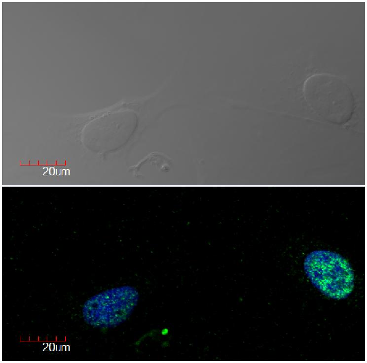 Anti-Ki-67 Monoclonal Antibody (Clone:Ki-67)