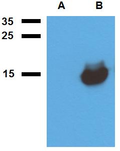 Anti-Mycobacterium tuberculosis antigen Acr1 Polyclonal Antibody