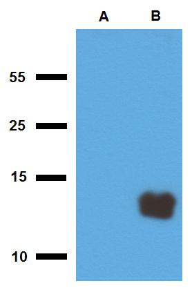 Anti-Mycobacterium tuberculosis antigen Tb10.3 Polyclonal Antibody