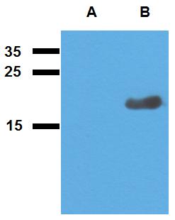 Anti-Mycobacterium tuberculosis antigen Acr2 Polyclonal Antibody