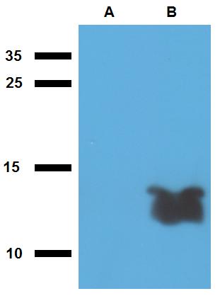 Anti-Mycobacterium tuberculosis antigen Tb7.7 Polyclonal Antibody