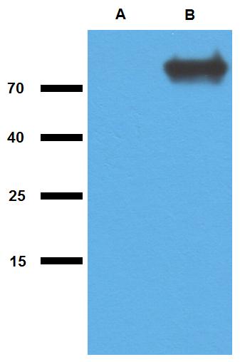 Anti-Mycobacterium tuberculosis antigen GlcB Polyclonal Antibody