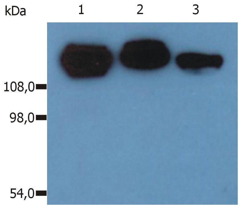 Anti-CD29 / Integrin beta1 chain Monoclonal Antibody (Clone:MEM-101A)