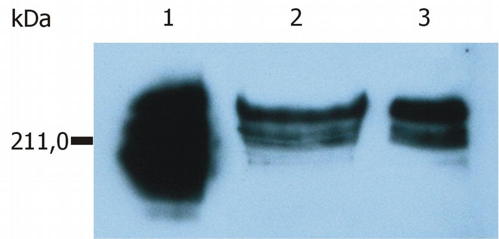 Anti-CD45RA Monoclonal Antibody (Clone:MEM-56)