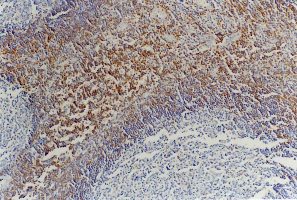 Anti-CD45RB Monoclonal Antibody (Clone:MEM-55)