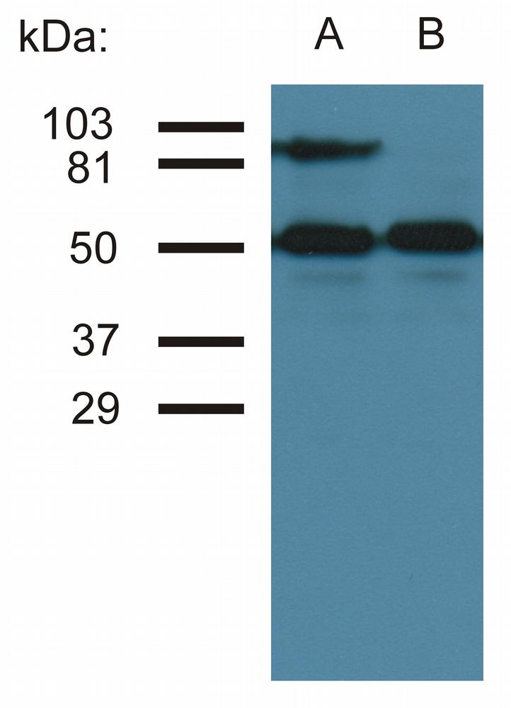 Anti-CD54 / ICAM-1 Monoclonal Antibody (Clone:MEM-111)