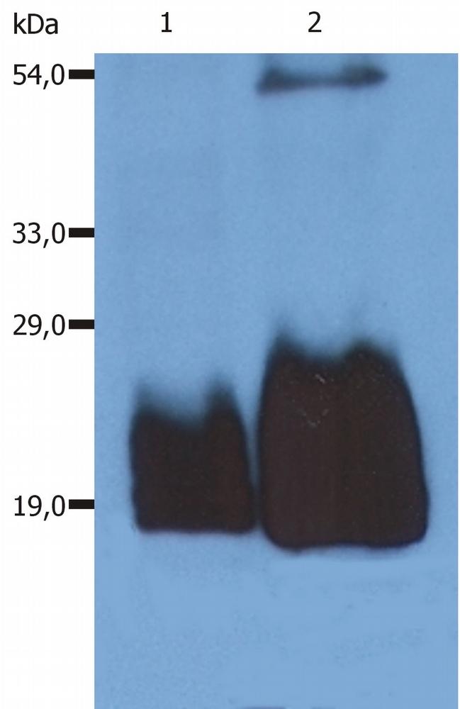 Anti-CD59 / Protectin Monoclonal Antibody (Clone:MEM-43/5)