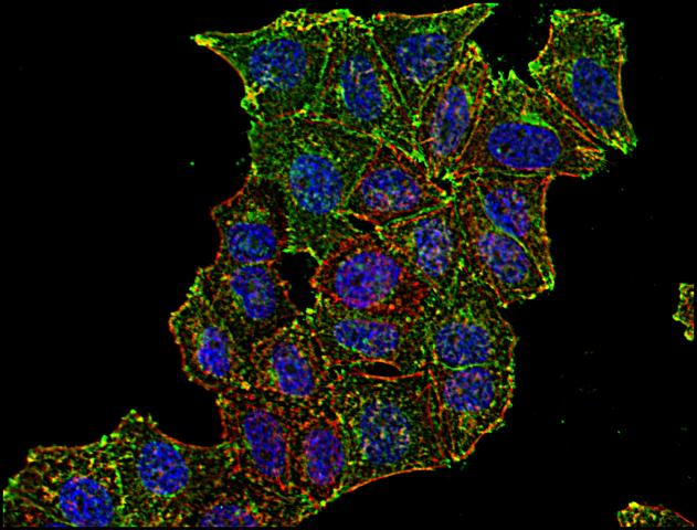 Anti-CD71 / Transferrin Receptor Monoclonal Antibody (Clone:MEM-75)