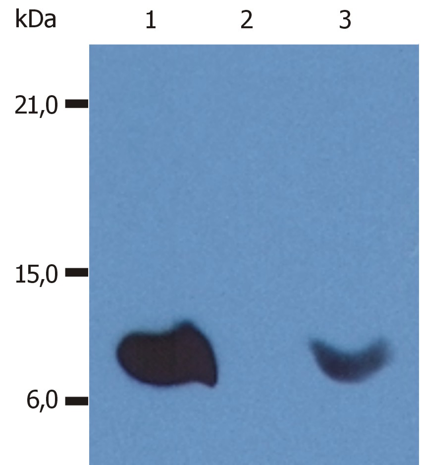 Anti-beta2-Microglobulin Monoclonal Antibody (Clone:B2M-01)