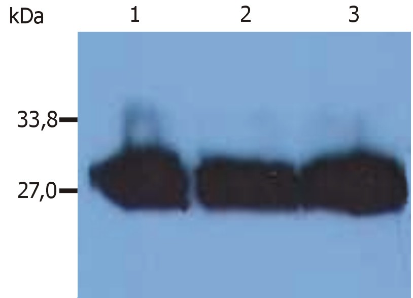 Anti-Kappa light chains Monoclonal Antibody (Clone:MEM-09)