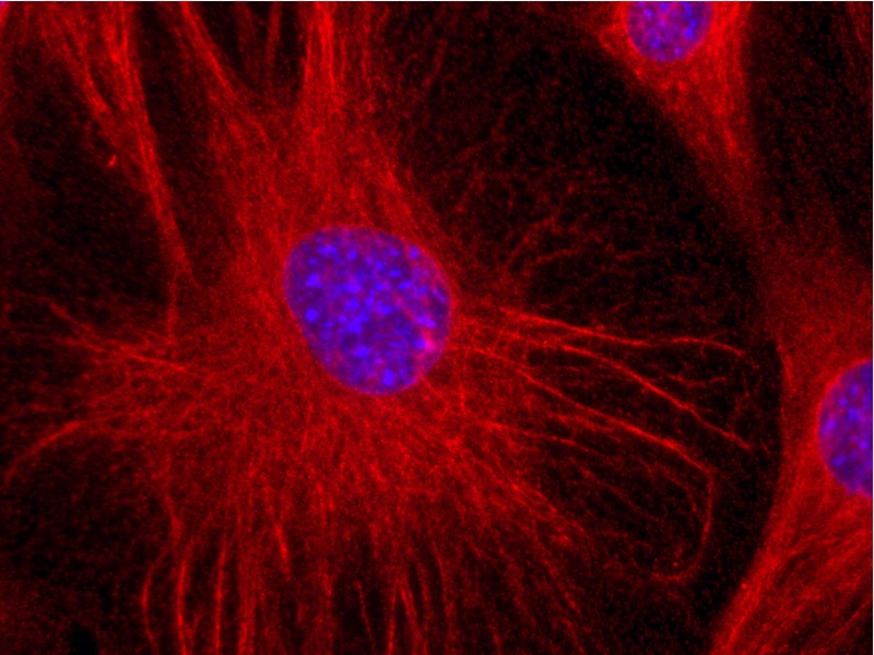 Anti-Vimentin Monoclonal Antibody (Clone:VI-01)