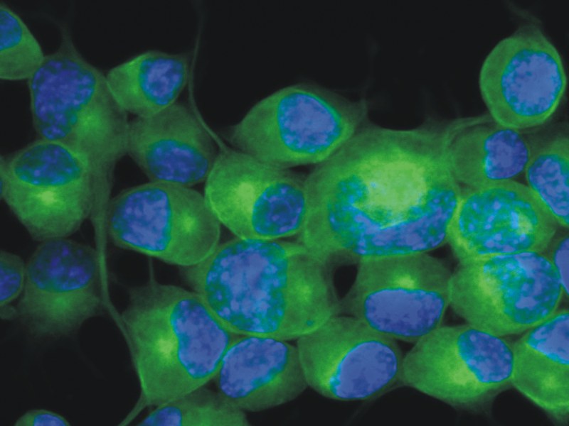 Anti-betaIII-tubulin Monoclonal Antibody (Clone:TU-20)