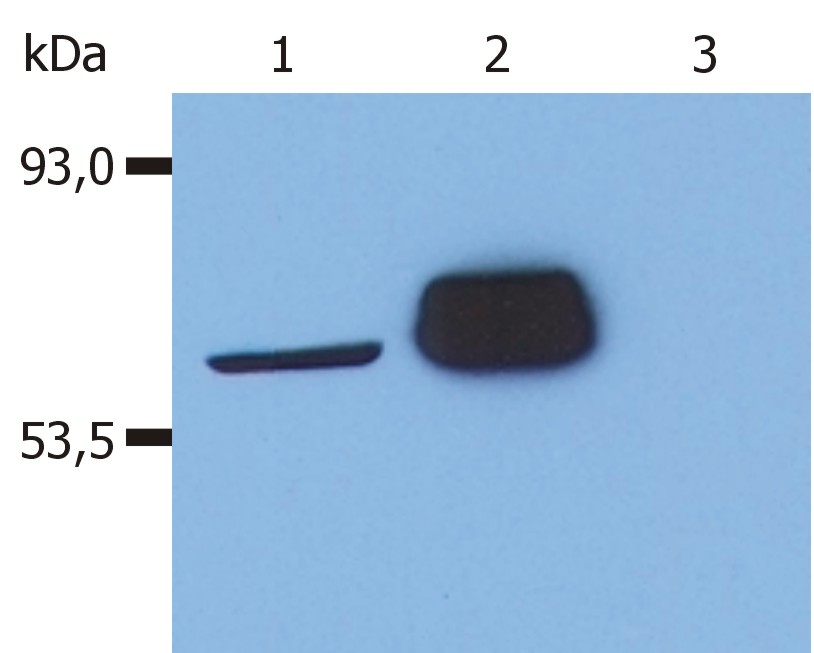 Anti-Lck Monoclonal Antibody (Clone:LCK-01)