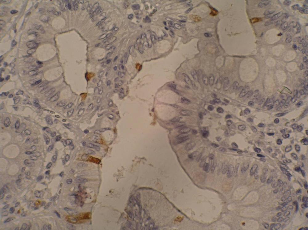 Anti-Sialyl Lewis a / CA-19.9 Monoclonal Antibody (Clone:121SLE)