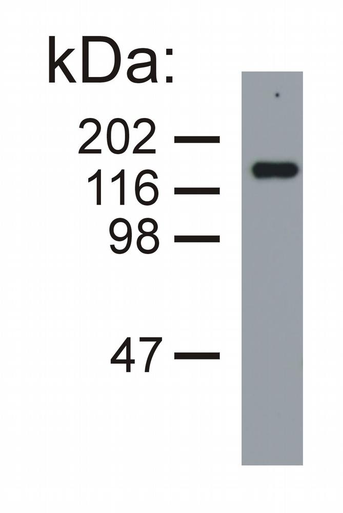 Anti-Neurofilament medium protein Monoclonal Antibody (Clone:NF-09)