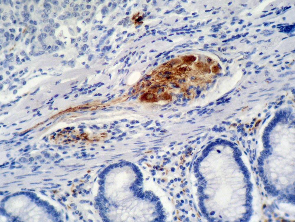 Anti-p21Waf1 Monoclonal Antibody (Clone:WA-1)(Discontinued)