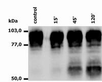 Anti-CD18 / Integrin beta2 subunit Monoclonal Antibody (Clone:MEM-148)