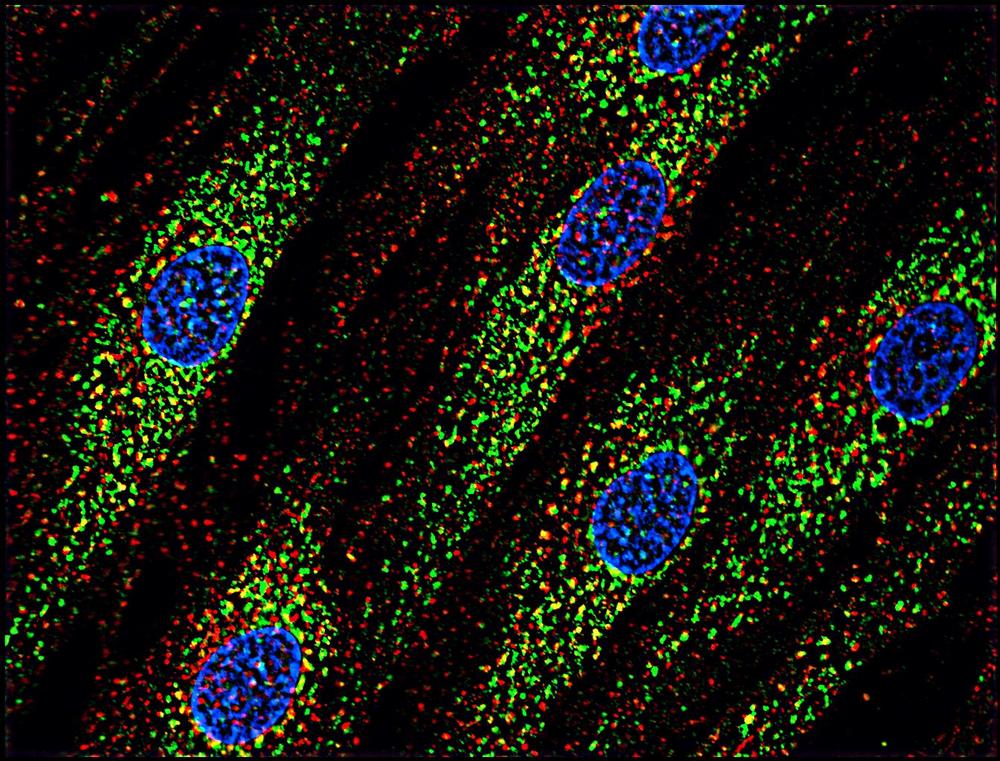 Anti-CD63 Monoclonal Antibody (Clone:MEM-259)