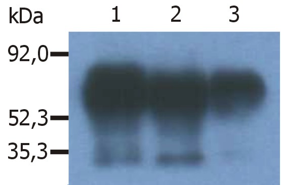 Anti-PAG / Cbp Monoclonal Antibody (Clone:PAG-C1)