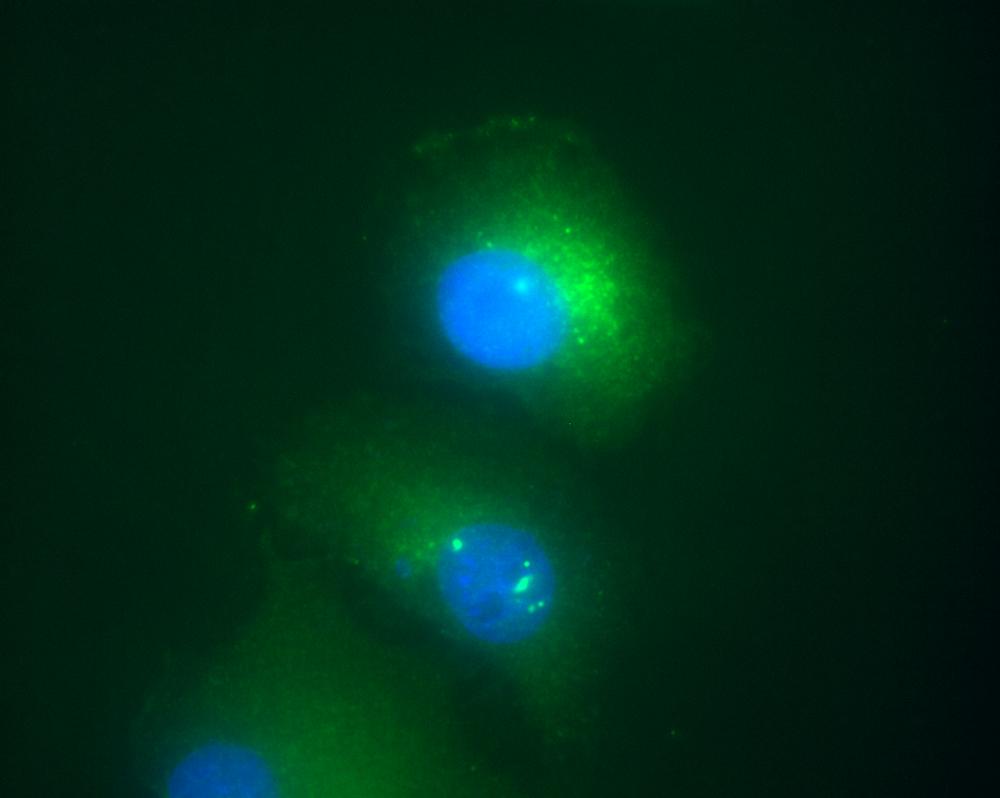 Anti-Daxx / DAP6 Monoclonal Antibody (Clone:DAXX-01)