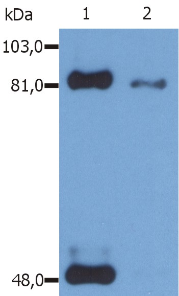 Anti-STAT1 (Phospho-Ser727) Monoclonal Antibody (Clone:PSM1)