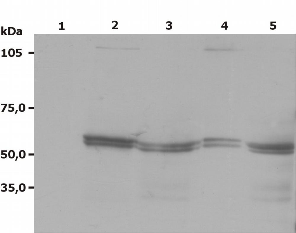 Anti-Lyn Monoclonal Antibody (Clone:LYN-01)