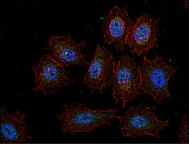 Anti-Csk Monoclonal Antibody (Clone:CSK-04)