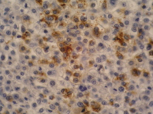 Anti-alpha-Fetoprotein Monoclonal Antibody (Clone:AFP-11)