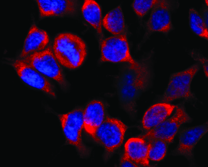 Anti-Kinesin (heavy chain) Monoclonal Antibody (Clone:KN-02)