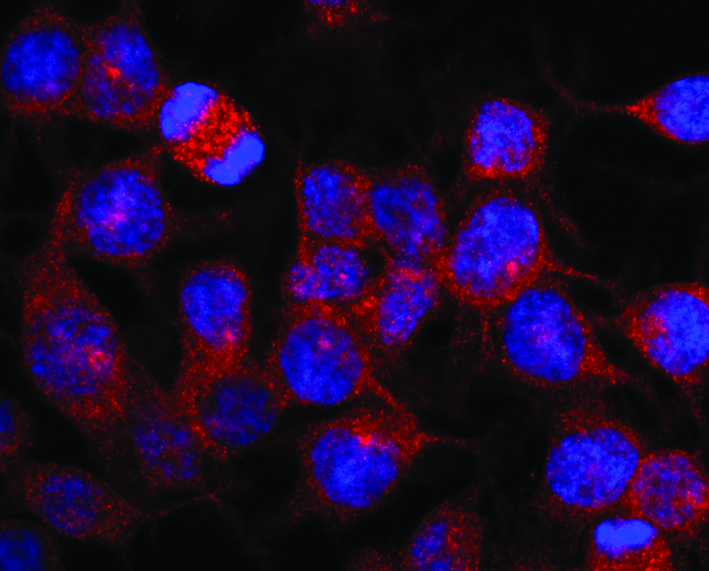 Anti-Kinesin (heavy chain) Monoclonal Antibody (Clone:KN-03)