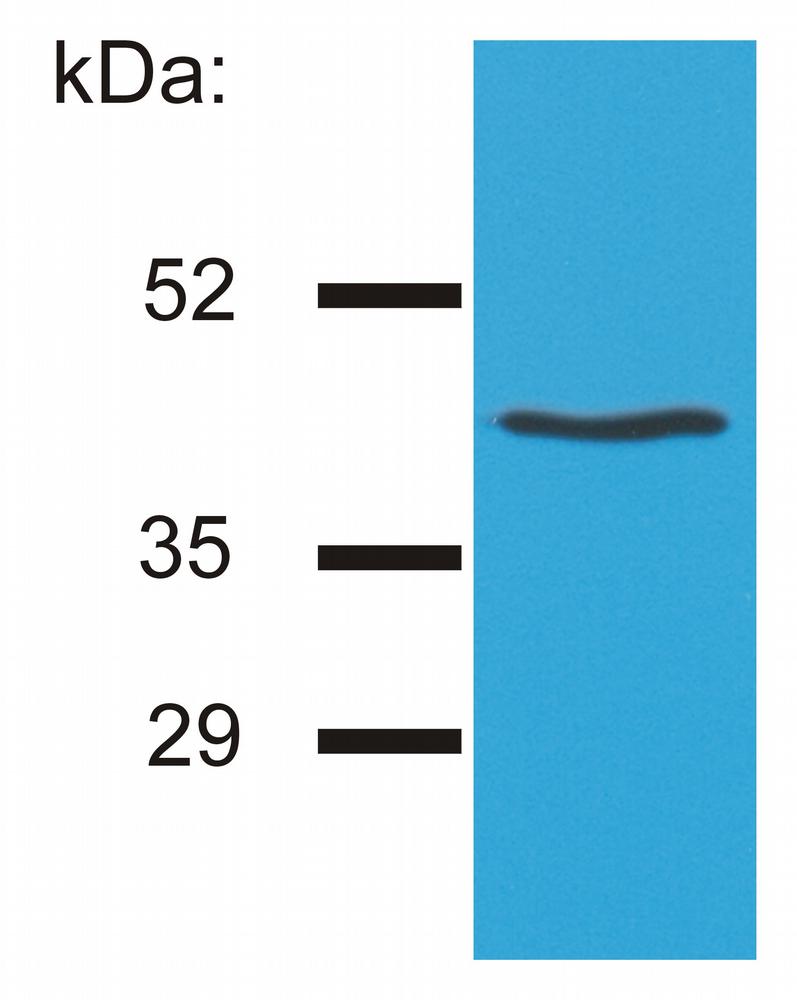 Anti-HLA-G Monoclonal Antibody (Clone:MEM-G/4)