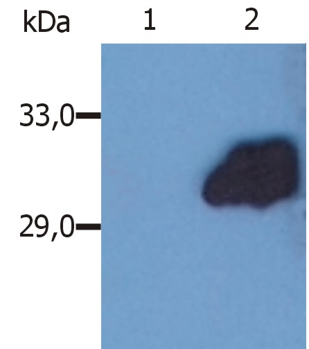 Anti-SOCS3 / Suppressor of cytokine signaling Monoclonal Antibody (Clone:SO1)