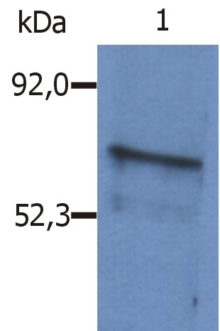 Anti-SLP65 / BLNK Polyclonal Antibody