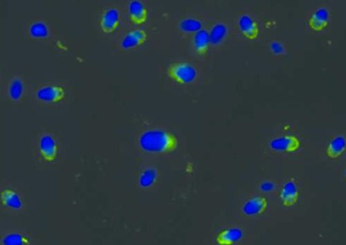 Anti-PRKAR2A Monoclonal Antibody (Clone:Hs-36)