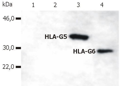 Anti-HLA-G Monoclonal Antibody (Clone:5A6G7)